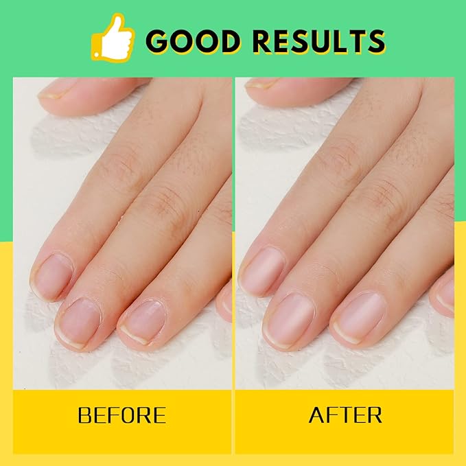 FANDAMEI Nail Buffer and File, Nail Care Kit with 3PCS Nail Files, 2PCS Nail Buffers, Rectangular Nail Buffer Block, Cuticle Nipper, Cuticle Pusher, Peeler. Cuticle Oil Milk and Honky Nail Manicure