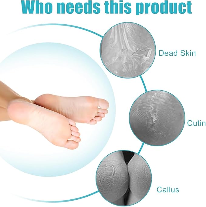 Foot File Callus Remover-2 Pcs 4 in 1 Foot Scrubber Dead Skin Remover for Feet,Pumice Stone, Foot Rasp and Sand Paper for Home Foot Care,Foot Brush for Shower (Red Pedicure Foot File)