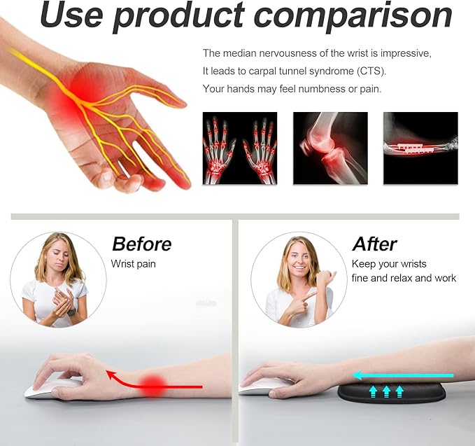 Vaydeer Cloud Elbow Pad, Desk Arm Rest Support, Soft Memory Foam Wrist Rest, Ergonomic Cushion Padding, Carpal Tunnel Pain Relief Gel Mouse Pillow for Computer Laptop Office Gaming Car Chair Accessory