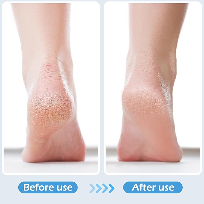 3 Pcs 4 in 1 Foot Brush for Use in Shower with Pumice Stone, Foot Rasp and Sandpaper, Foot Scrubber Brush for Feet, Dead Skin Remover for Foot Care (3 Colors)