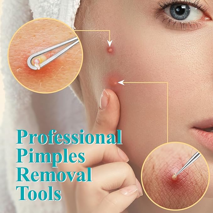 Tweezers for Women Facial Hair, 10 in 1 Pimple Popper Tool Kit with Tweezers, Eyebrow Tweezers Kit with Eyebrow Trimmer & Scissors, Razor, Travel Bag, Hair Plucking Daily Beauty Tools